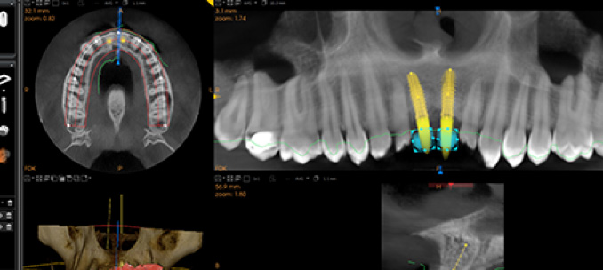 CBCT 3D imaging system - Sanz Pancko Dental