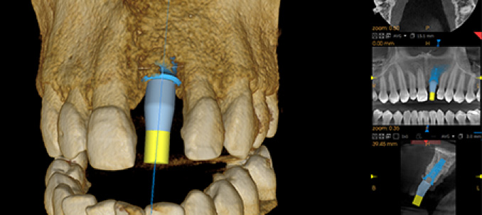 CBCT 3D imaging system - Sanz Pancko Dental