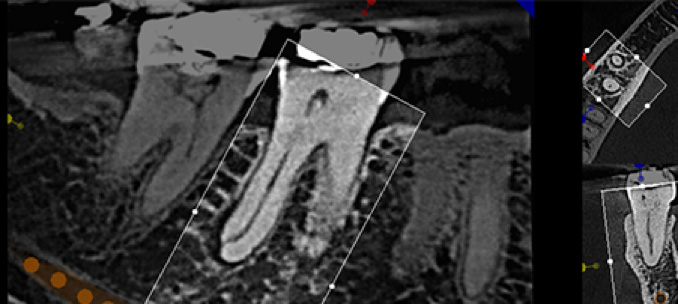 CBCT 3D imaging system - Sanz Pancko Dental