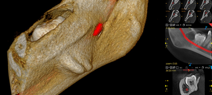 CBCT 3D imaging system - Sanz Pancko Dental