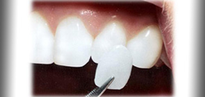 Tratamientos - Clínica Dental Sanz&Pancko Barcelona